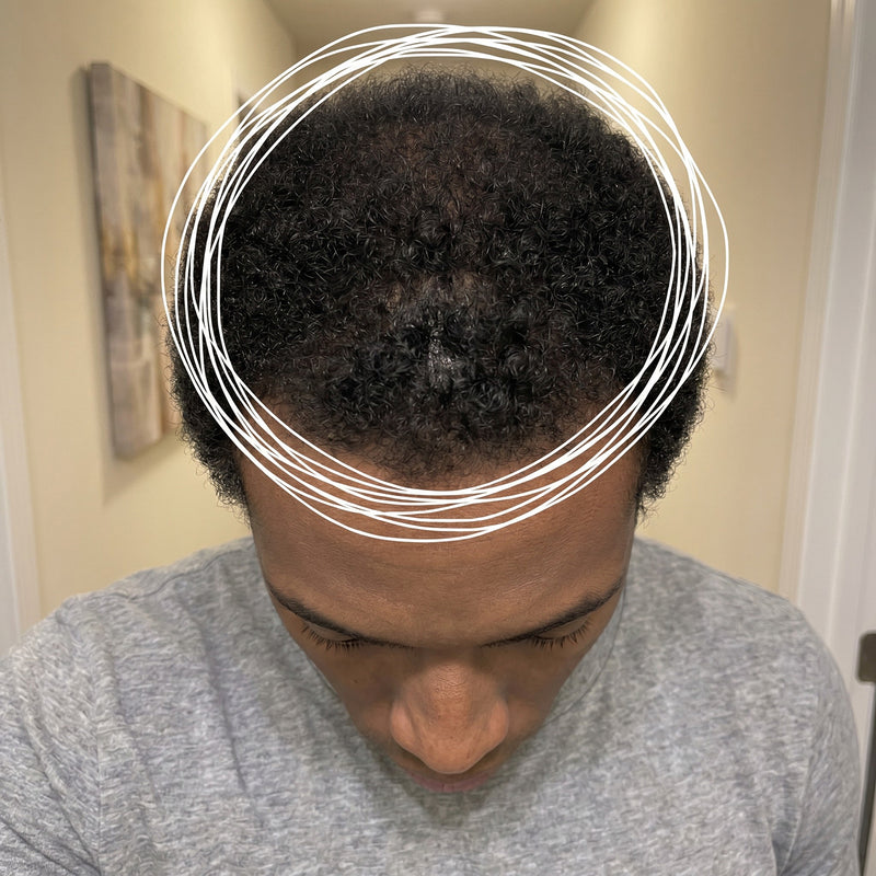 TERRELL after