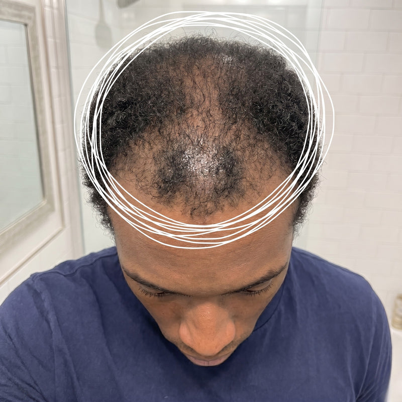 TERRELL before