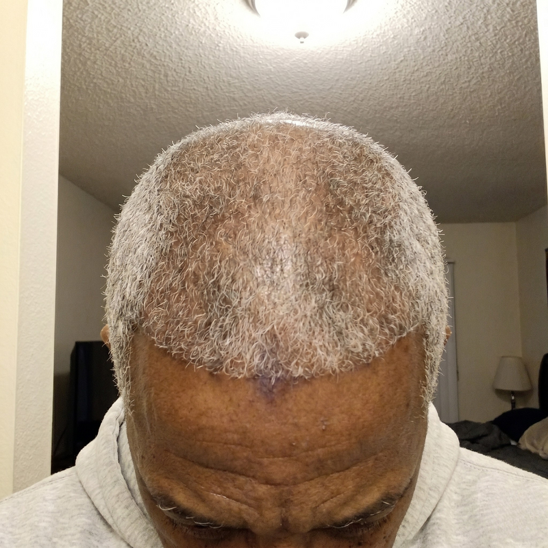 TERRELL after