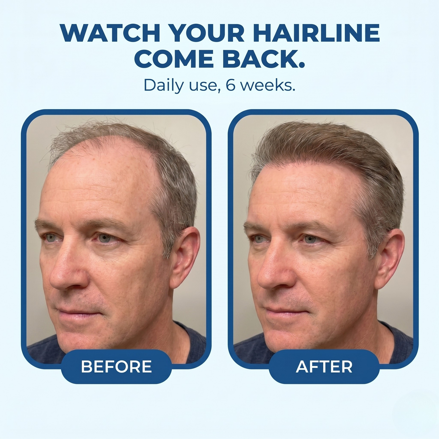 Regrowth Roll-On Serum