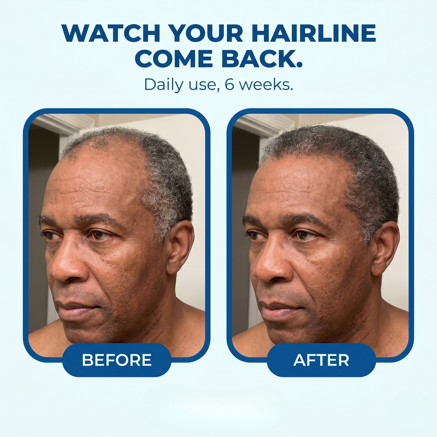 Regrowth Roll-On Serum