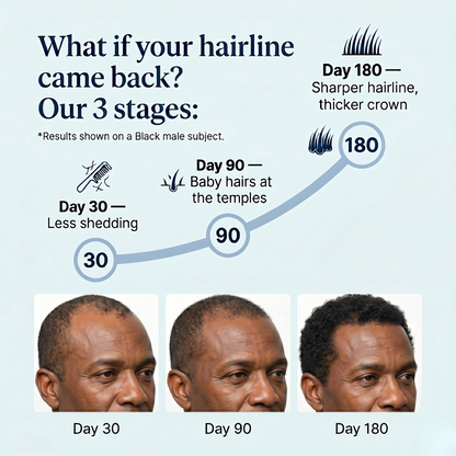 Hair Regrowth Roll-On Serum