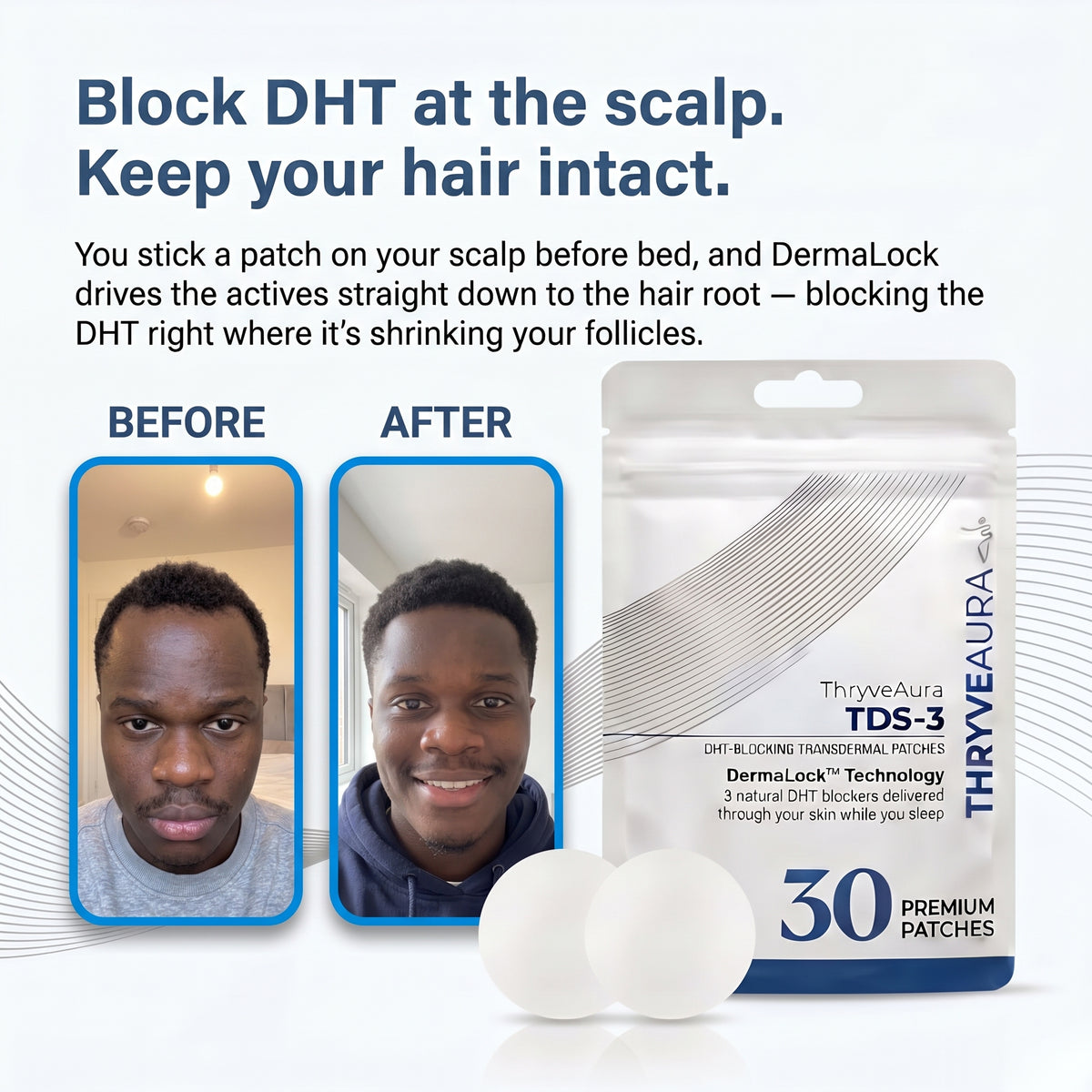 DHT Blocking Patches