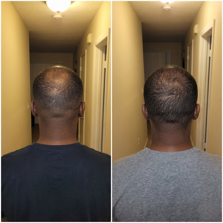 Wake Follicles