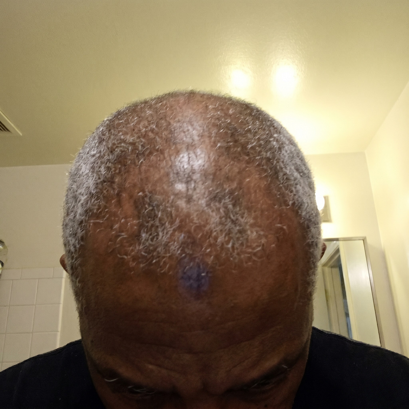 TERRELL before
