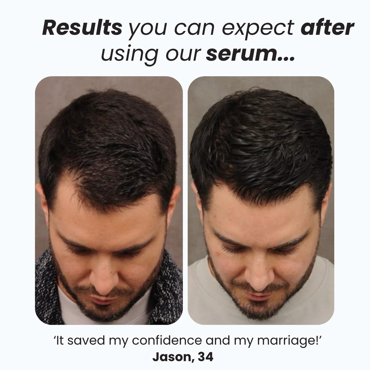 Hair Growth Roll-On Serum